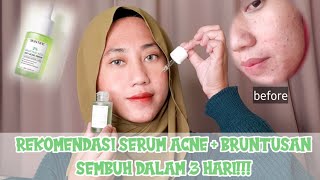 REVIEW SKINTIFIC 2 SALICYLIC ACID ANTI ACNE SERUM  SERUM UNTUK JERAWAT amp BRUNTUSAN [upl. by Cid340]