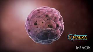 What is Azoospermia Dr Ibrar Ahmad  Malka Fertility and IVF center [upl. by Reivilo987]