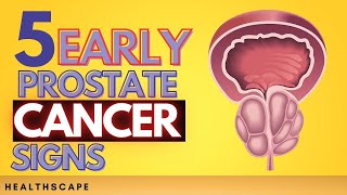 5 Early Prostate Cancer Signs You Should Not IGNORE [upl. by Alegnasor]