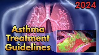 Asthma Treatment According to GINA Guidelines 2024 [upl. by Rosemarie]