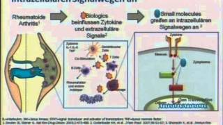 Update Rheumatologie 2013 [upl. by Doloritas65]