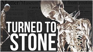 Stone Man Syndrome  The Man With a Second Skeleton Disturbing Disorders [upl. by Yuk]