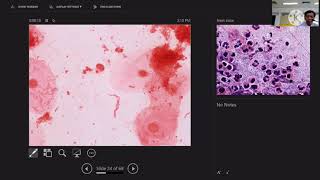 การอ่านและรายงานผล Gram stain Acidfast stain และ Modifiedacid fast stain 1415 ตค 64 [upl. by Segalman]