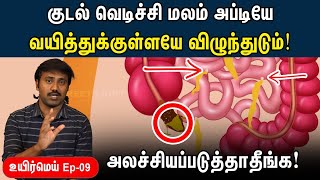 யாருக்கெல்லாம் appendix பிரச்சனை வரும்  Appendicitis explained in Tamil  Uyirmei EP  09 [upl. by Tan366]