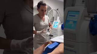 Coolsculpting no Joelho clinicalucianahitomi procedimentosesteticos [upl. by Janeen]