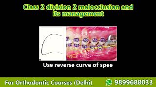 orthodontics treatment planning Part 4 Class 2 div 2 malocclusion Orthodontic Courses Lecture [upl. by Elden]