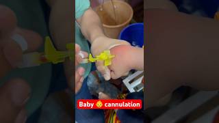 Baby 👶 cannulation  cannulation cannula shorts trending baby SMpharmacy plz subscribe [upl. by Ahsiuqel331]