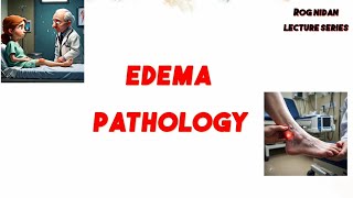 Edema pathology lecture ROG NIDAN BAMS [upl. by Anyt]