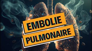 EMBOLIE PULMONAIRE et PHLEBITE  tout comprendre  WhyDoc 1 [upl. by Carey]