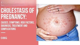 cholestasis in Pregnancy CIP [upl. by Feerahs]