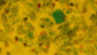 Entamoeba coli  trophozoite [upl. by Clo]