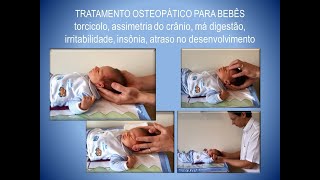 Bebê de 2 semanas Exame e tratamento pela Osteopatia craniossacral [upl. by Vyse]