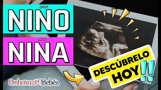 Cómo saber si es NIÑO o NIÑA por Ultrasonido  SEMANA 12 a 20 ¡Detecta las diferencias [upl. by Ynnaffit435]