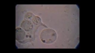 Trichomonas hominis con Blastocystis fagocitados e intento de fagocitosis de otro [upl. by Quitt500]