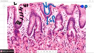 Stomach Histology Slide  Understanding Stomach Mucosa Med Madness [upl. by Atiuqaj]