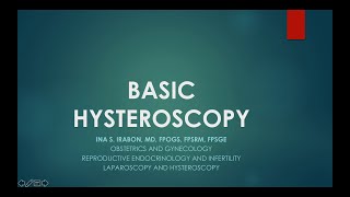 basic hysteroscopy [upl. by Ayahsey]