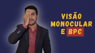 PESSOA COM VISÃO MONOCULAR TEM DIREITO AO BPC [upl. by Alat]