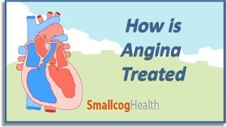 How is Angina Treated [upl. by Darla]