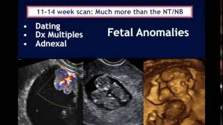 AIUM Webinar Systematic Evaluation of the 1114 Week Fetus Touching on ISUOG Guidelines [upl. by Ondrea633]