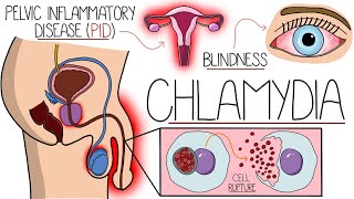 Understanding Chlamydia Chlamydia Trachomatis Explained Clearly [upl. by Button]