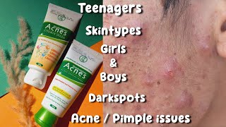 Facewash for acne  Acnes facewash review  pimple solution face wash Acne treatment [upl. by Aire826]