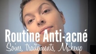 Acné  Traitements Soins amp Makeup HD 720p [upl. by Ddej160]