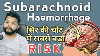 Subarachnoid Haemorrhage Kya Hota Hai  Subarachnoid haemorrhage Cause Symptoms amp Treatment Hindi [upl. by Rebekah]