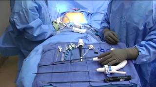 Single Site Laparoscopic Cholecystectomy  Introduction and Instruments [upl. by Nasar]