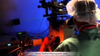 ICSI Procedure  IVF Intracytoplasmic Sperm Injection [upl. by Ylicis]