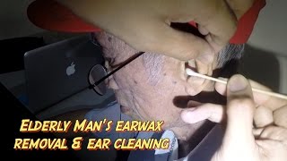 Elderly Mens Earwax Removal amp Ear Cleaning [upl. by Ddarb]