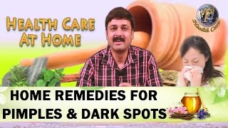 HOME REMEDIES FOR PIMPLES ACNE AND DARK SPOTSII कील मुहासों और काले धब्बो का घरेलू उपचार II [upl. by Adolf]