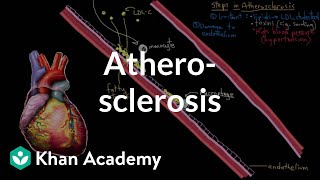 Atherosclerosis  Circulatory System and Disease  NCLEXRN  Khan Academy [upl. by Vescuso]