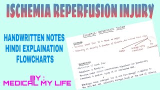 Ischemia Reperfusion Injury [upl. by Shir602]