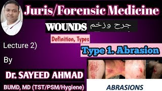 Jurisforensic medicinewoundsdefinitiontypesAbrasionMLC importance 3rd profLec2 [upl. by Alamaj]