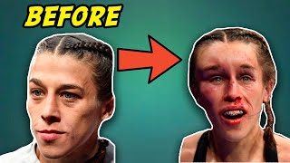 Massive Hematoma Doctor Explains Joanna Jedrzejczyk Forehead at UFC 248 [upl. by Eimac915]