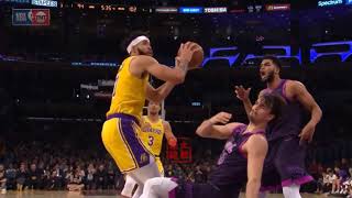 JaVale McGee Breaks Dario Saric Teeth With Nasty ElbowsFlagrant LA Lakers vs Timber wolves [upl. by Frankel59]