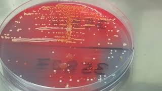 Staphylococcus saprophyticus colony morphology on CLED agar [upl. by Ysirhc]