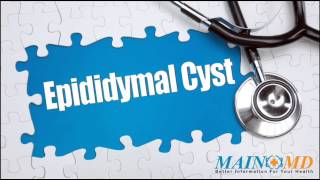 Epididymal Cyst ¦ Treatment and Symptoms [upl. by Peppel]