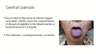 Cyanotic Congenital Heart Disease En  Soha Romeih [upl. by Ragas]