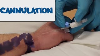 How to Perform Cannulation  OSCE Guide old version  UKMLA  CPSA [upl. by Prunella]