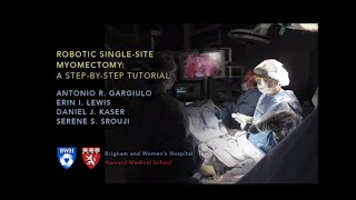 Robotic Singlesite Myomectomy Video  Brigham and Women’s Hospital [upl. by Maximo]