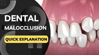 What is Dental Malocclusion Quickly Explained in a Few Seconds [upl. by Ringo]