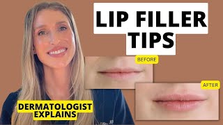 Dermatologist Shares 9 Lip Filler Tips to Know Before and After Treatment [upl. by Shakespeare]