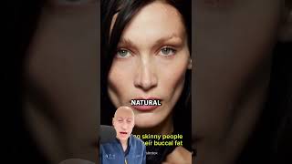 Why Youll Regret Buccal Fat Removal [upl. by Izy213]