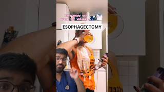 DOCTOR REACTS to ESOPHAGECTOMY and ESOPHAGOSTOMY [upl. by Seaden]