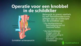 Knobbel in de schildklier [upl. by Nho]