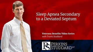 Sleep Apnea Secondary to a Deviated Septum [upl. by Norahs686]