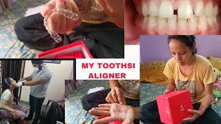 My Toothsi Aligner Day 1Unboxing of Toothsi AlignerBraces Precaution in IndiaToothsi [upl. by Lenahtan319]