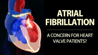 Atrial Fibrillation amp Heart Valve Disease Surgeon Insights with Dr Marc Gerdisch [upl. by Idelson]