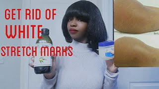 add this to your vaseline to get rid of white stretch marks [upl. by Eboh]